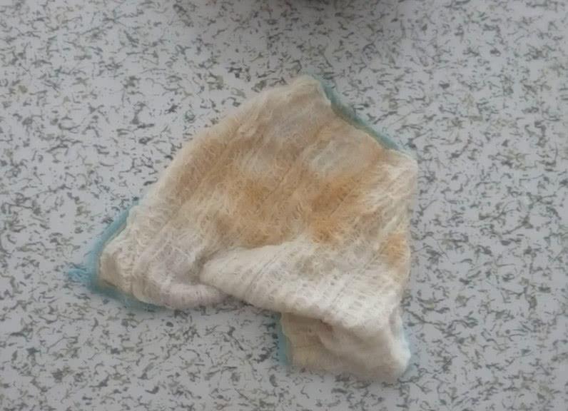 洗碗抹布油腻腻的洗不干净,原来要这样洗才洗的干净,这么简单
