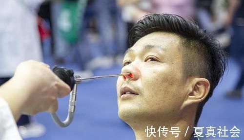 过敏性鼻炎|鼻炎反反复复,别不当回事!做好这3件事,或能避开它