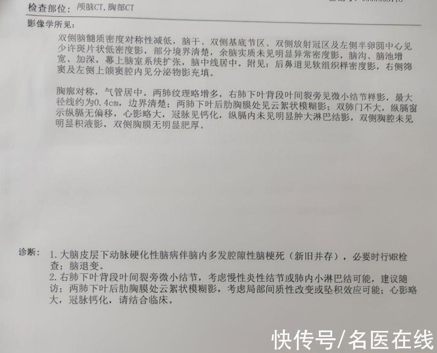 脑梗死|75岁大爷感冒后，腿脚不灵活，话也说不清！医生：脑梗上门了