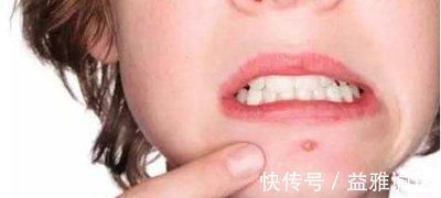 名方|一个调理脾肾阳虚的千古名方,仅5味药,发挥强大威力,脾肾同补