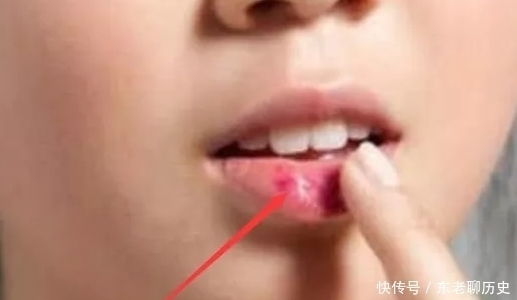 唇妆|学生党“贼伤嘴巴”的3动作,多数00后已中招,变“火锅嘴”可别哭