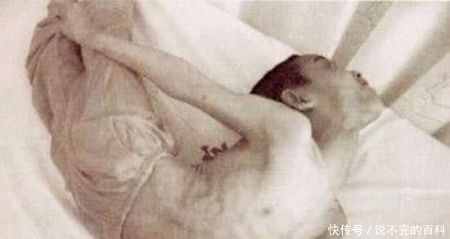 古代著名毒药“牵机药”,到底是啥实物好笑,解药更好笑!