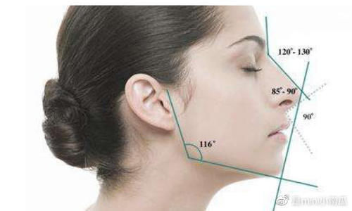 t截骨|下巴整形的3种方法:注射、假体、T截骨,哪个适合你?区别在哪?