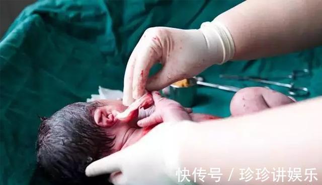手术|剖腹产仅是“挨一刀”对身体伤害有多大,医生终于说了大实话!