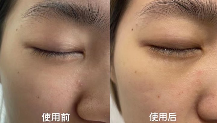 精准|功能型面膜VS补水面膜，精准和精简之间你选对了吗