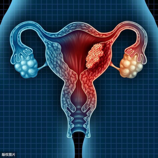 处会|医生忠告女性“子宫”报废,身体3处会“发黑”,别撑到宫颈癌