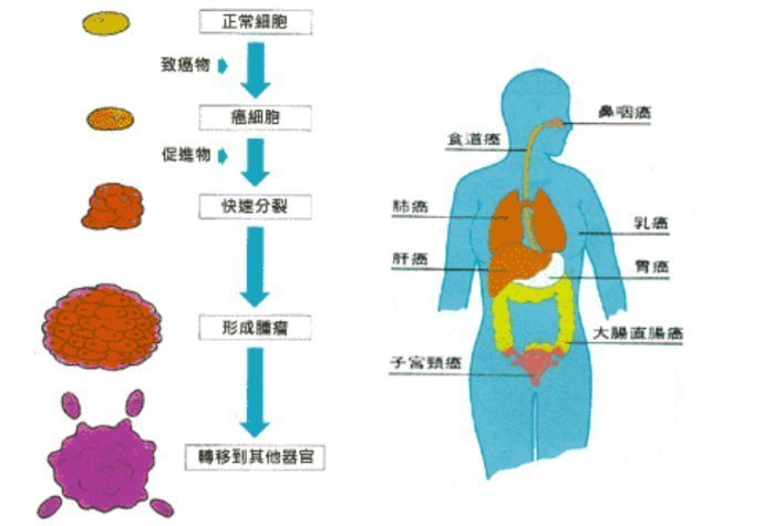 肿瘤|成都中医肿瘤医院：只要找对方法，坚持治疗，恶性肝肿瘤也能好转