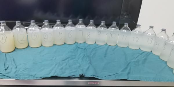 肺泡蛋白|胸闷气喘半年,男子肺里洗出19升“牛奶”