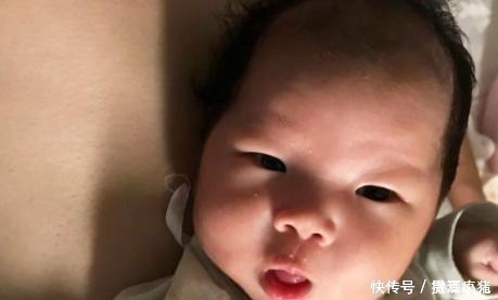 病情加重|2岁宝宝经常挠头,频繁洗头也不见缓解,送医后医生摇头来晚了