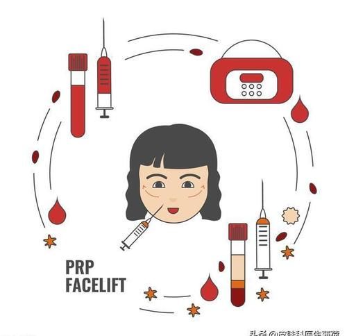 把血抽出来再打到脸上？这是什么丧心病狂的美容方法