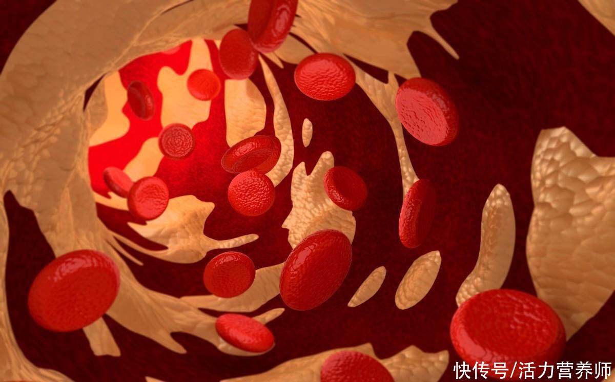 总胆固醇|45岁以上的人，血压、血脂、血糖、尿酸最标准的对照表，你符合吗