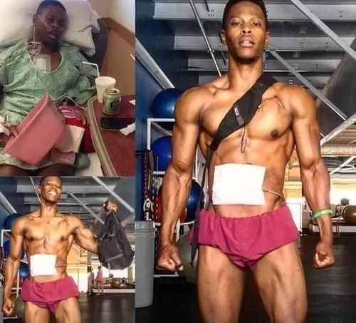 他没有心脏却仍坚持健身,美国27岁小伙感动全球