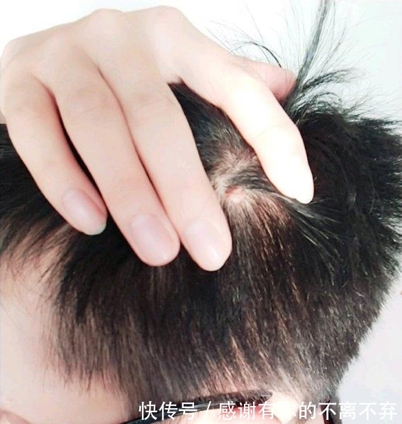 眉毛|用大蒜在眉毛上擦两下，可能发生这几个变化！看完记得收藏