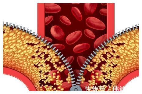 手脚冰凉|睡觉出现这些“微”症状,暗示血脂超标了早点发现,避免并发症