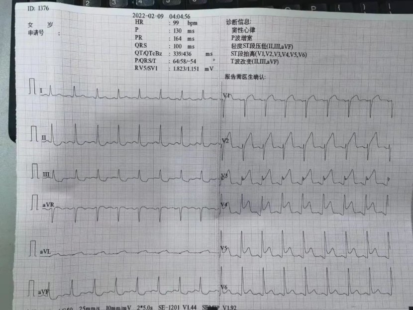 患者|淄博市中心医院两院区无缝接力，成功救治危重急性心肌梗死患者