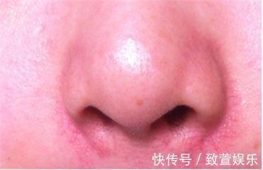 调理|脾胃不好“生百病”,一味中药,调理各种脾胃不适,一起了解下!