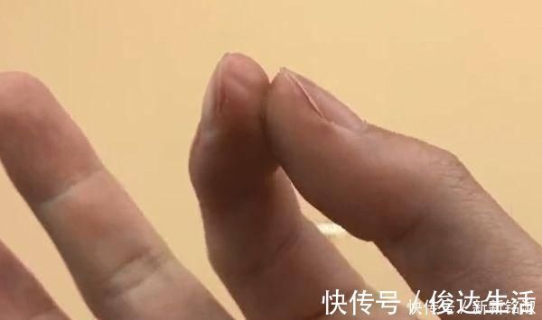 妙招|手指被502胶水粘住了别着急只需要泡一泡，胶水立马融化