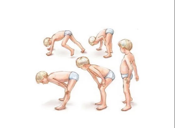 遗传|肌营养不良症是什么引起来的?肌营养不良能治好吗?