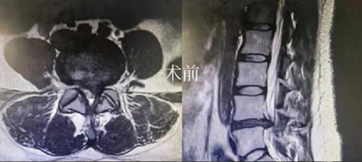 医疗|山东省立三院脊柱脊髓外科：有温度的医疗服务，获外国患者点赞