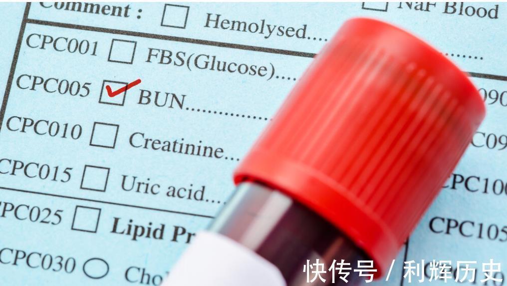 服用|天天服用二甲双胍，最终却出现肾损坏！医生揪出最大的幕后凶手