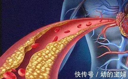 决明子|生活中如何降低血脂,中医推荐这2种中药!