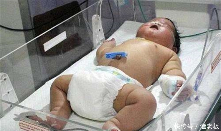 孩子出生就有32斤,护士双手都抱不动,网友:怎么可能?