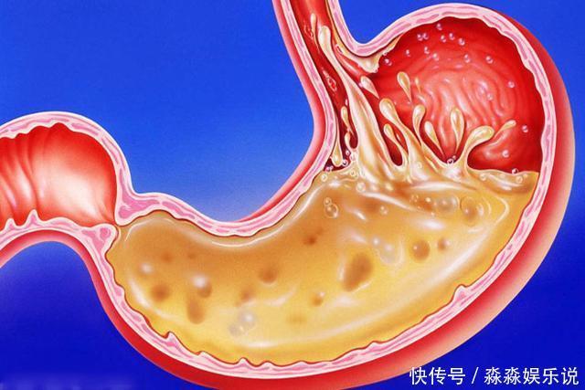 蜂蜜|胃不舒服的人，早上起来多做4件事，保护胃黏膜，预防便秘