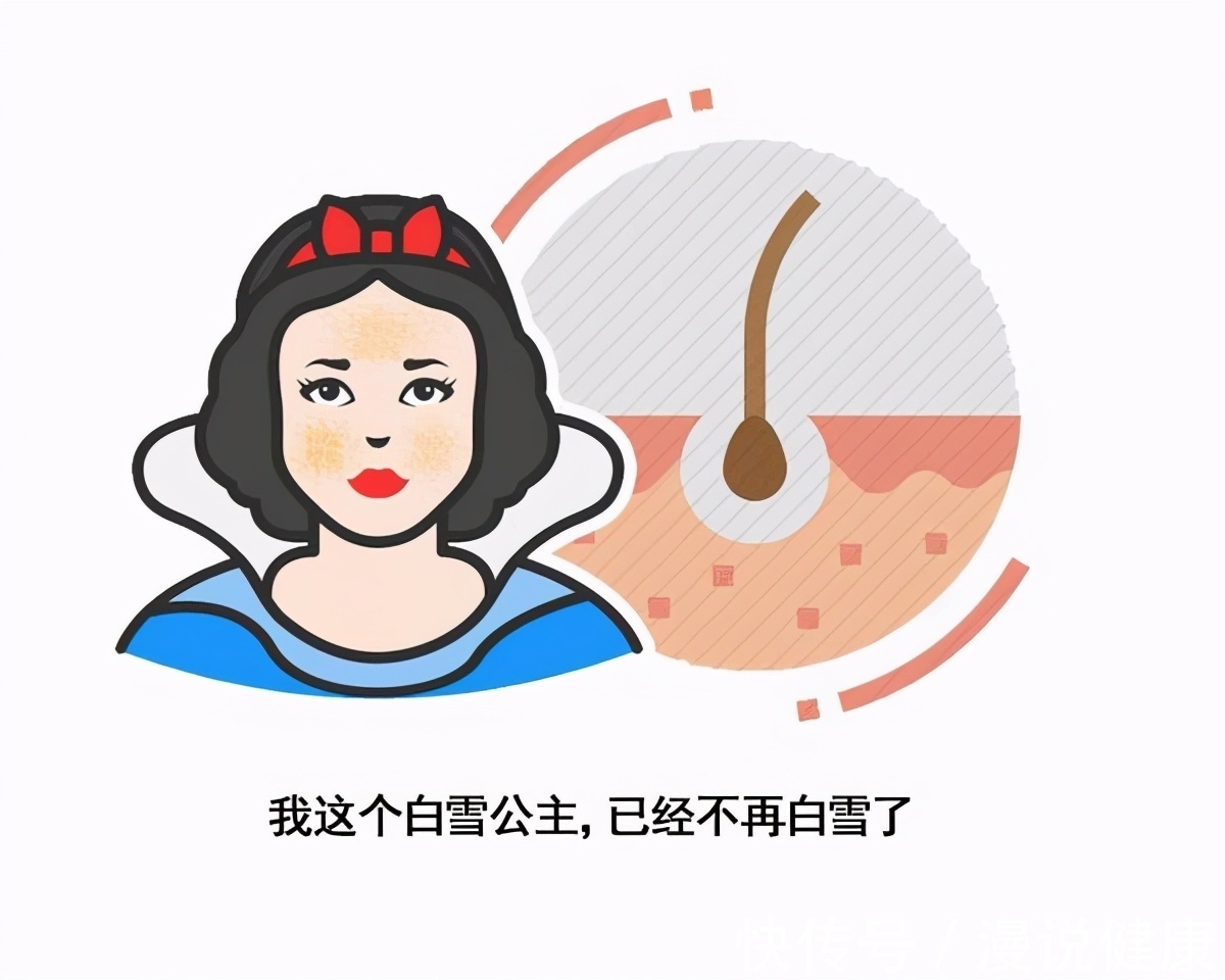 运动医学|30万人11年的随访!最新研究:睡眠不足,还可以用这种方式来补救