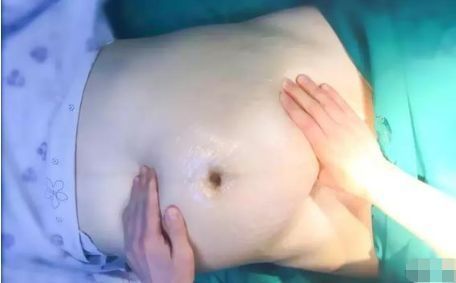 怀孕生娃|婆婆说“你先顺产，实在顺不下来再剖”，我该听还是不听？