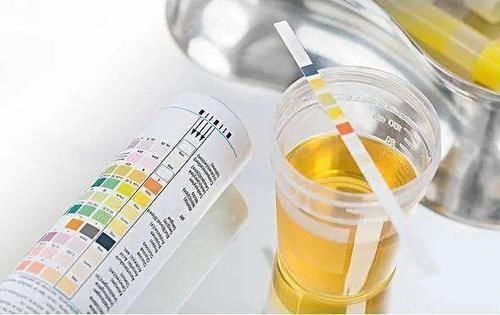 肾脏|糖尿病患者出现哪些症状,说明发生了肾脏损害?重点观察两项指标