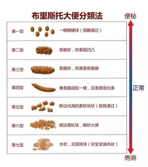 排便|便秘别只知道吃香蕉,这4个通便秘小技巧,胜过开塞露