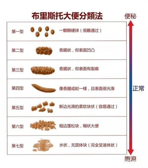 排便|便秘别只知道吃香蕉，这4个通便秘小技巧，胜过开塞露