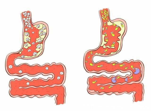 复合菌|肠道“推粪机”出现,并非红薯香蕉,平时经常吃,便秘绕道走