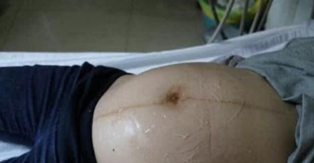 涂抹|产检做B超时,医生涂抹的“透明液体”究竟是啥?多数人不知道