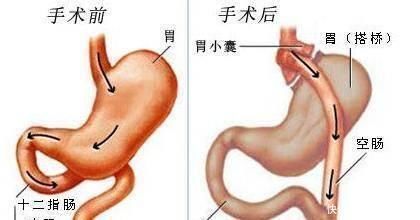 糖尿病人|糖尿病必须终身用药关于糖尿病的十大谣言，咱们来好好驳斥