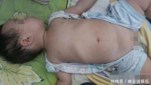 婴儿车|6个月大的宝宝脊椎变形,医院检查后,得知原因让父母后悔不已