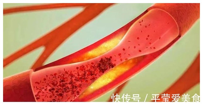 猪油|猪油渣是血管的“良药”，还是血管的“杀手”？一起来了解一下