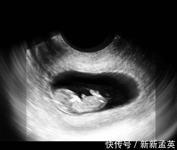 胚胎|胎儿从卵泡到性别形成,17张图片清晰诠释,男宝女宝看得很清楚