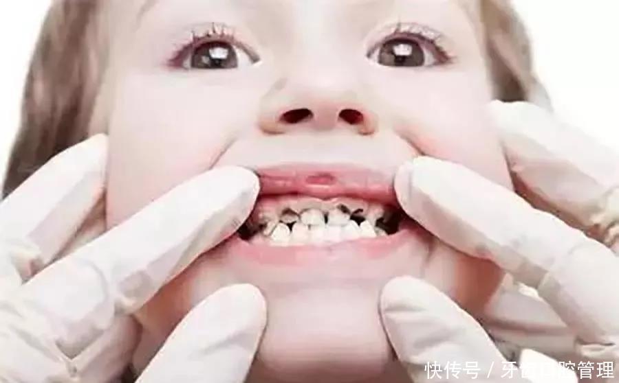 牙齿|每个去看牙的孩子，牙齿都疼好久了