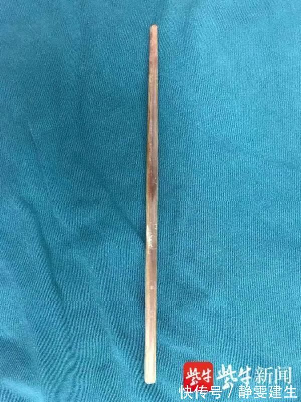 筷子|一根筷子把2岁多孩子的脖子戳穿!这些物品家有宝宝的要格外小心