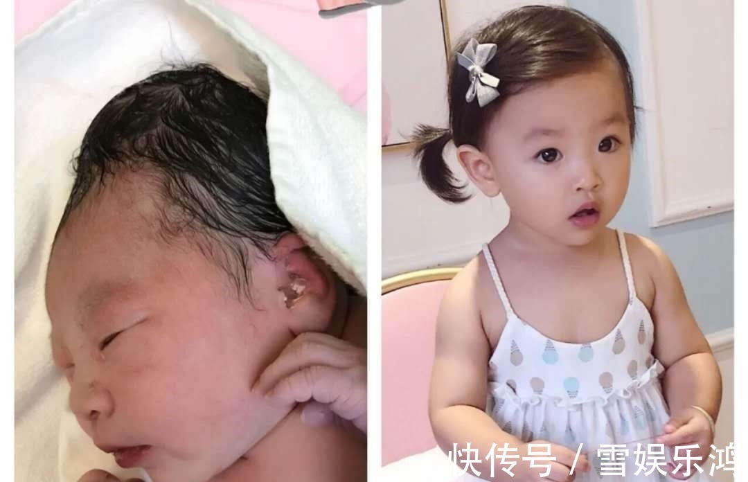 浮肿|新生儿这几个部位丑,反而预示高颜值,宝宝逆袭的我你高攀不起