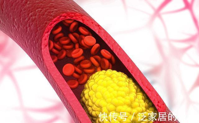 贫血|血压正常,却经常头晕,这是怎么回事?“6种疾病”平时要多留意