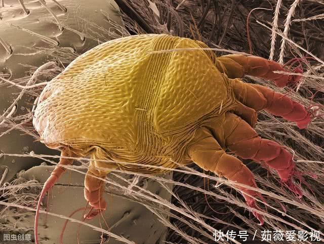 头上4种迹象频发，八成是螨虫堆积成山了！2个方法帮你轻松除螨