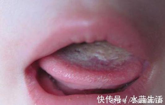 小勇|男童半年长高16cm,儿科医生:3种食物助长高,日常可以多吃