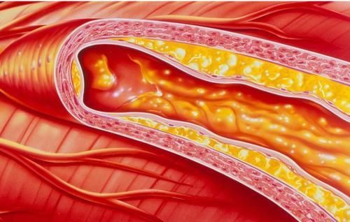 血脂|吃一口等于5斤芹菜,医生呼吁:血液粘稠常吃,清血管降血脂,血管会更好