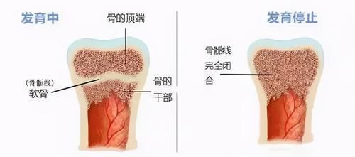 健康大讲堂|儿科医生：到了这个年龄，男孩基本已经“截止长高”，家长别错过