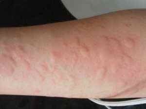 杠把子|健脾“杠把子”被找到,山楂靠边站,孩子若爱吃,消积健脾长高个