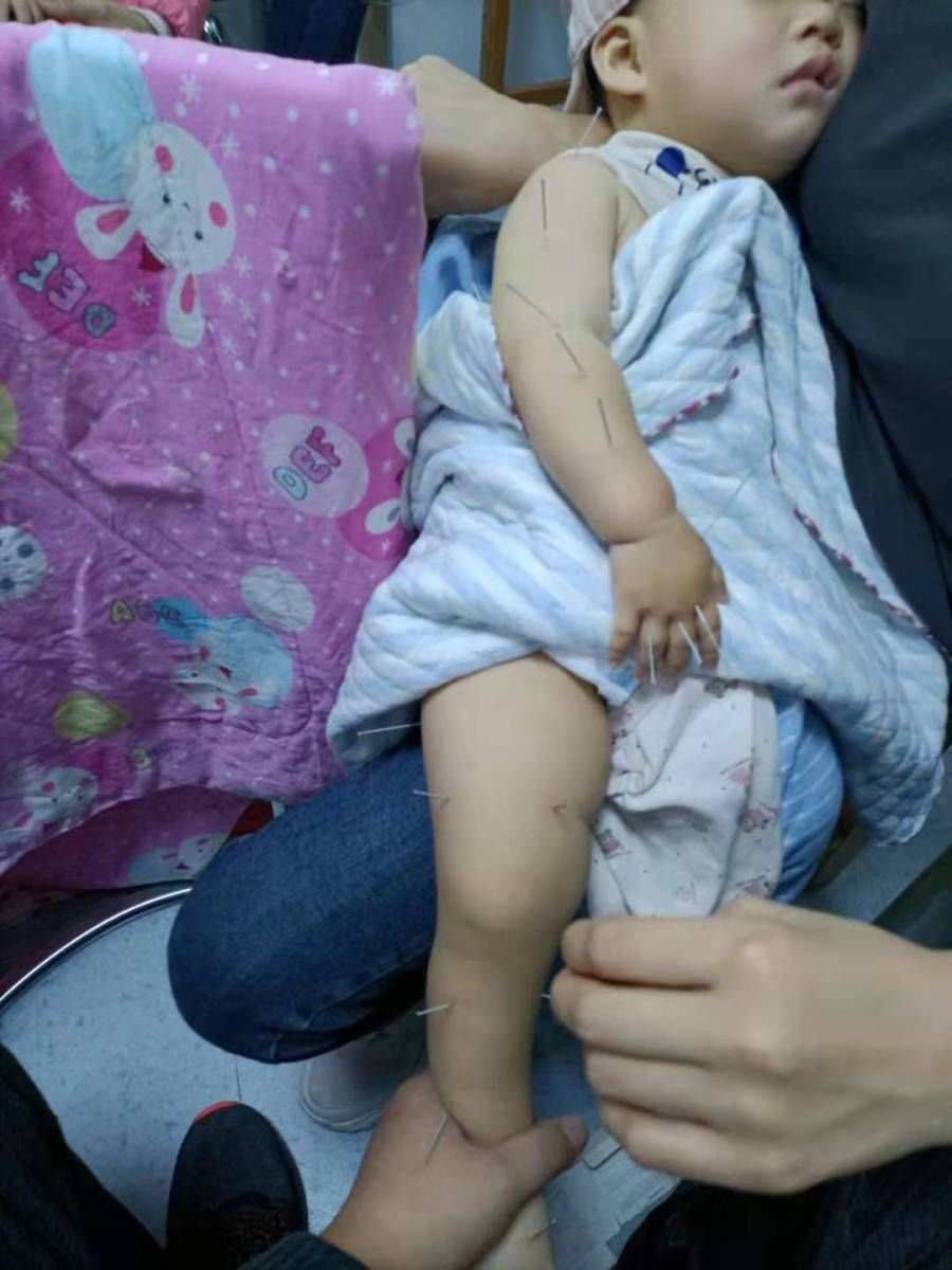 青岛市妇女儿童医院|10个月大婴儿床上坠落致脑梗塞，负担不起高额治疗费，谁来帮帮这个家？