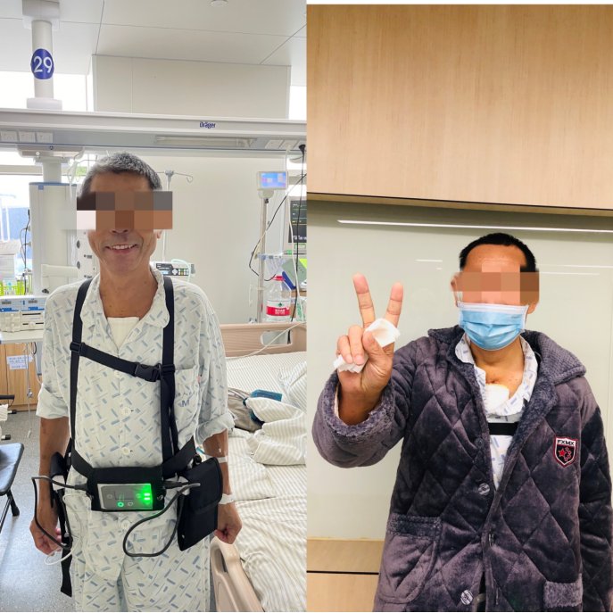 邵主任|这家医院，一周内完成两例“人工心脏”手术！