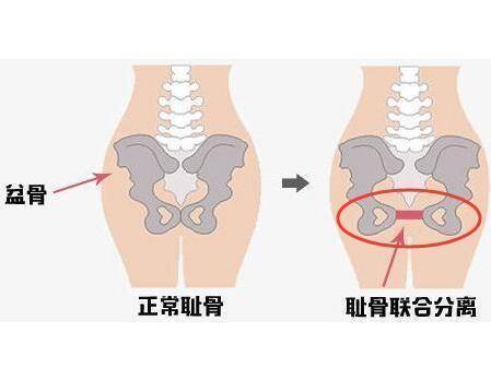 小宝宝|怀孕后，孕妈身体出现5个“不适”，说明胎儿在向妈妈报平安呢